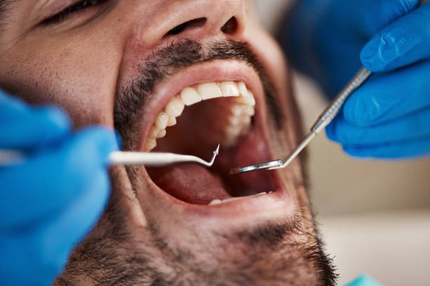 Best Broken Tooth Emergency  in Essex Village, CT